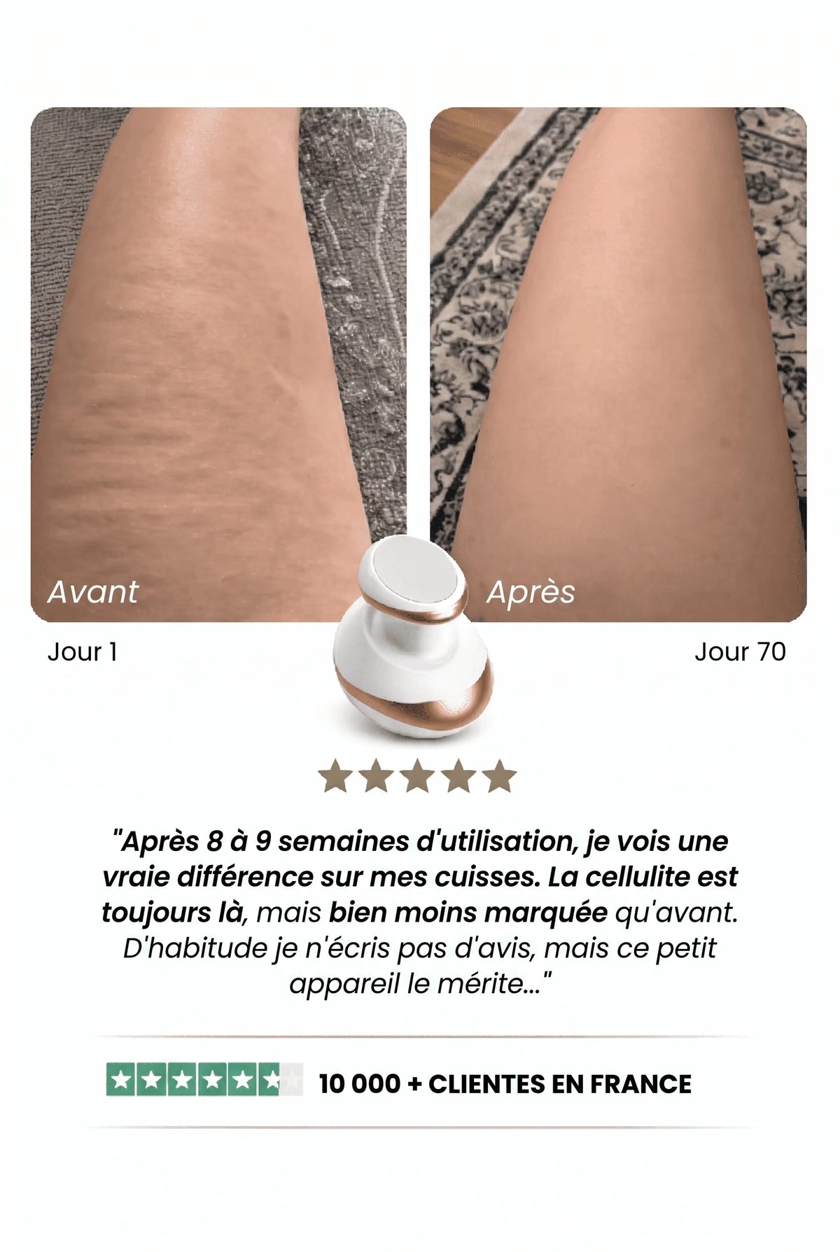 Dalya - Peau Lisse en 14 jours