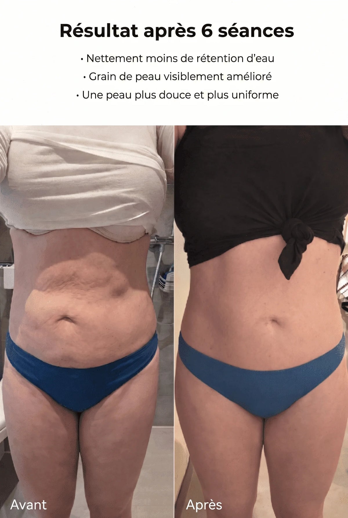 Dalya - Peau Lisse en 14 jours