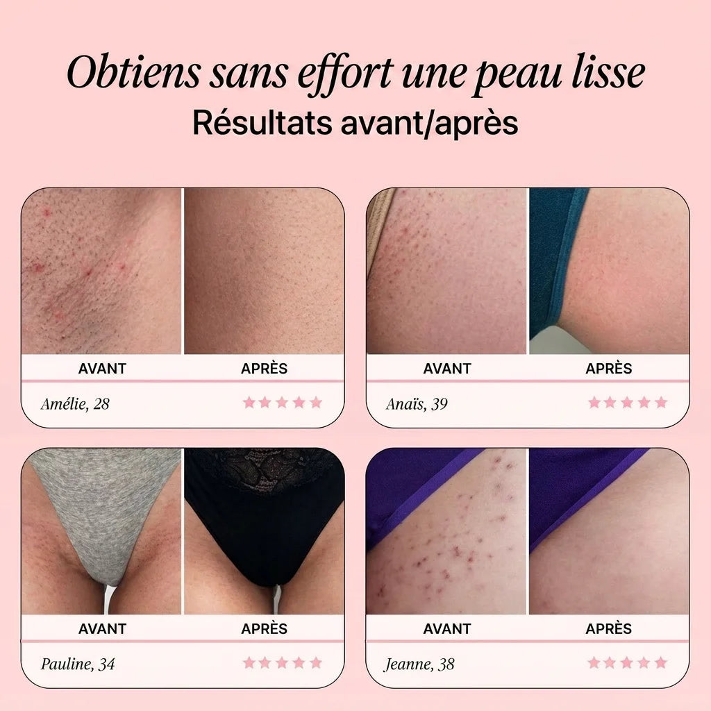 Rasoir de sûreté Dalya
